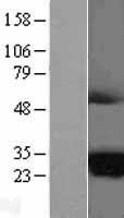NBL1-06997 - MARCH2 Lysate
