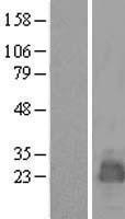 NBL1-06998 - MARCH2 Lysate