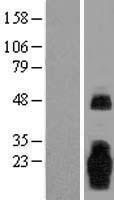 NBL1-06999 - MARCH3 Lysate