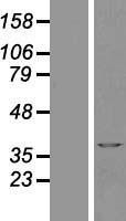 NBL1-07804 - MATH1 Lysate