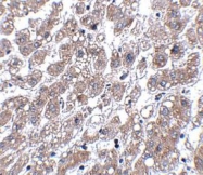 NBP1-77350 - Matrilin-1
