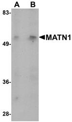 NBP1-76325 - Matrilin-1