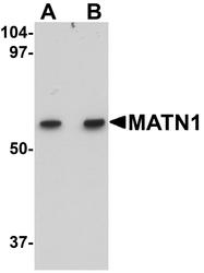 NBP1-77350 - Matrilin-1