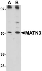 NBP1-77017 - Matrilin-3