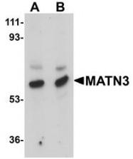 NBP1-77022 - Matrilin-3