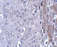 NBP1-77012 - Matrilin-4