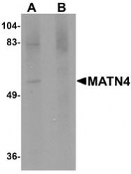 NBP1-77012 - Matrilin-4