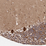 NBP1-83431 - MDP1