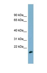 NBP1-56573 - MDP1