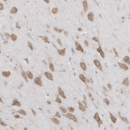 NBP1-85104 - MED28