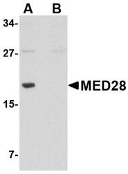 NBP1-76931 - MED28