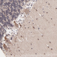 NBP1-92115 - ZNF764