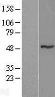 NBL1-18245 - MGC13138 Lysate