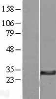 NBL1-13074 - MGC4172 Lysate