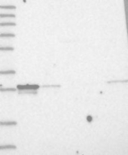 NBP1-82828 - MITD1