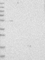 NBP1-88691 - MKS1