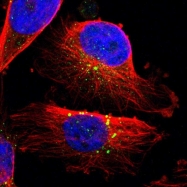 NBP1-92126 - Neprilysin-2 / MMEL1
