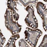 NBP1-92126 - Neprilysin-2 / MMEL1