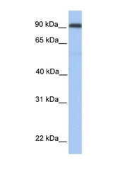 NBP1-59349 - Neprilysin-2 / MMEL1