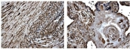 NB110-60989 - MMP-8
