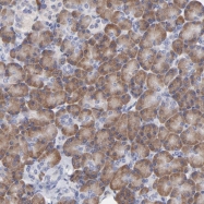 NBP1-93499 - MOSPD2