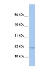 NBP1-56328 - Mpv17-like protein / MPV17L