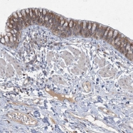 NBP1-83850 - MRPS18A
