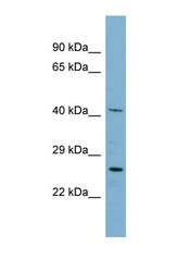 NBP1-54663 - MRPS2