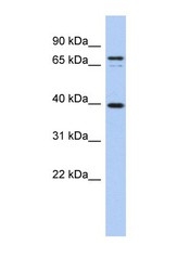 NBP1-59621 - MS4A14