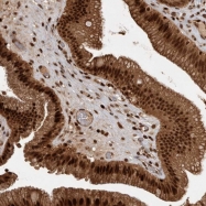 NBP1-87844 - MSK2