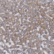 NBP1-93617 - MYO16