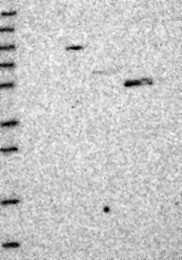 NBP1-93617 - MYO16