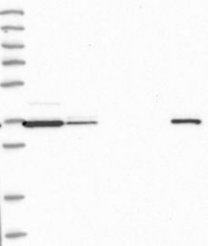 NBP1-92094 - H2AFY2 / MACROH2A2