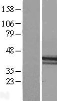 NBL1-11426 - Macro H2A.2 Lysate