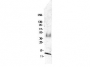 NBP1-77897 - Tumor necrosis factor (TNF-alpha)