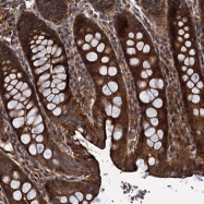 NBP1-89628 - Meckelin