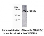 NBP1-06590 - Meckelin