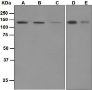 NBP1-95723 - UNC13D