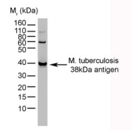 NB100-62769 - Mycobacterium tuberculosis
