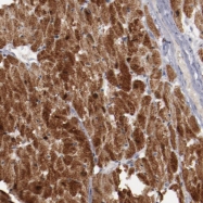 NBP1-87496 - Myomesin-2