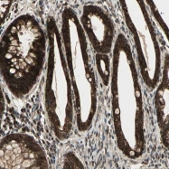 NBP1-87591 - Myomesin-2