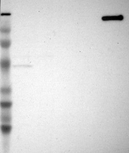 NBP1-87496 - Myomesin-2