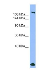 NBP1-57681 - Myosin-1 / MYH1