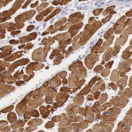 NBP1-85542 - Myosin-14 / MYH14
