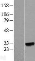NBL1-13451 - N6AMT2 Lysate