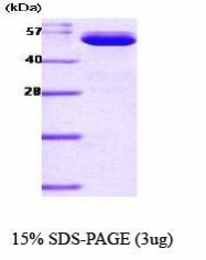 NBC1-18474 - Visfatin / NAMPT