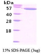 NBC1-18484 - Visfatin / NAMPT