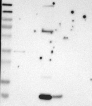 NBP1-89921 - NAP2 / PPBP / CXCL7
