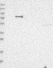 NBP1-84082 - NAV1 / Neuron navigator 1