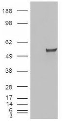 NBP1-00182 - Estrogen-related receptor gamma